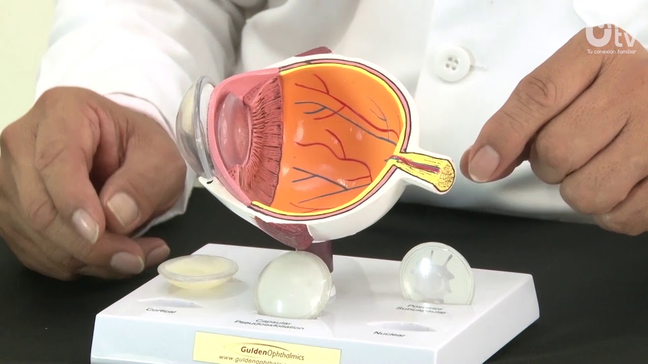 Edgar Angel Hidalgo Pecho-72