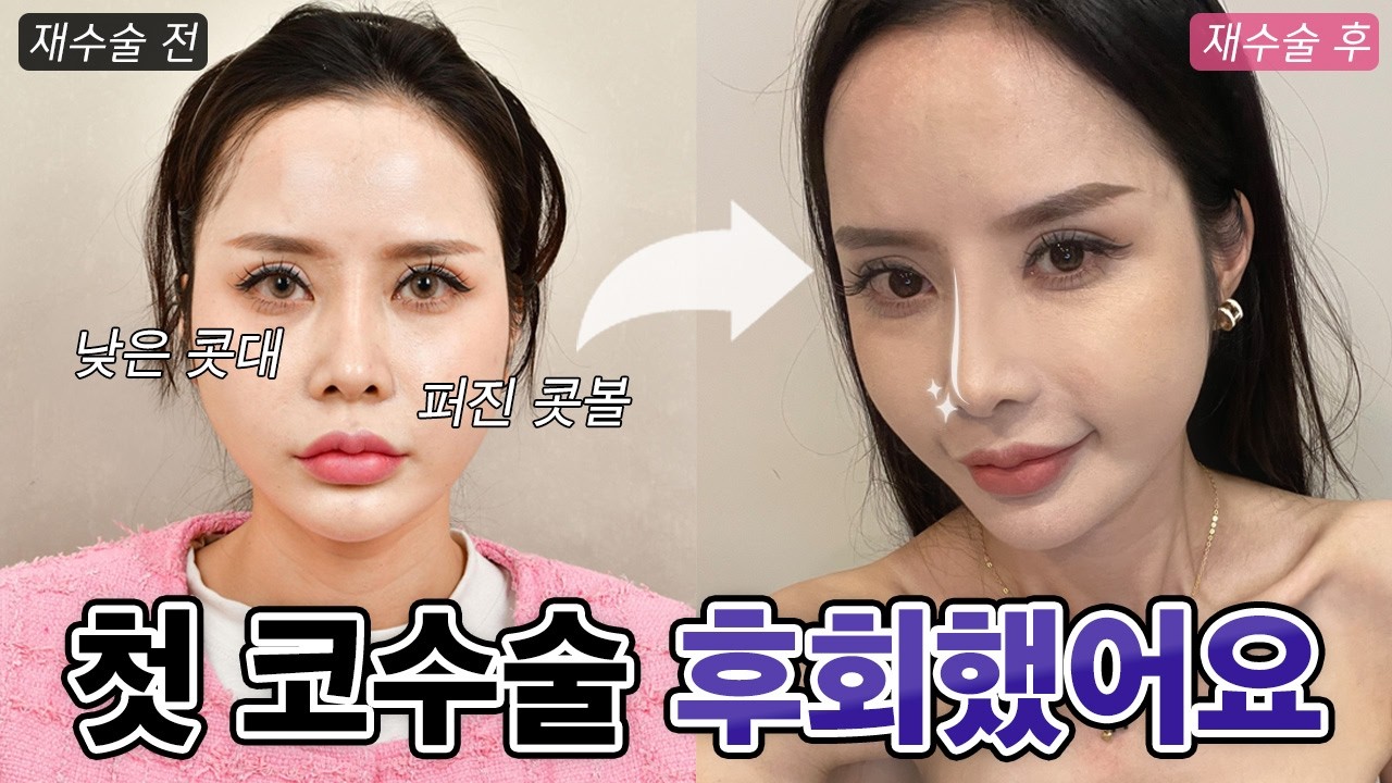 영상 썸네일