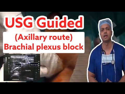 USG GUIDED (AXILLARY  ROUTE) BRACHIAL PLEXUS BLOCK | Explained with Video | #anesthesia #medical
