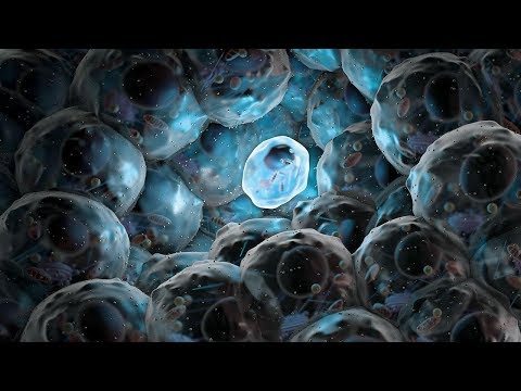 Click to Watch the Stem cell study provides new hope for MS patients video