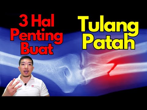 3 important things for BROKEN BONES!