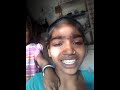 Dise Mms Video