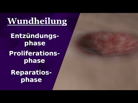 Wundheilung | In 5 MINUTEN verstehen | 3D Animation