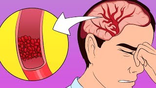 A Scientific Way to Cure a Headache Without Painkillers