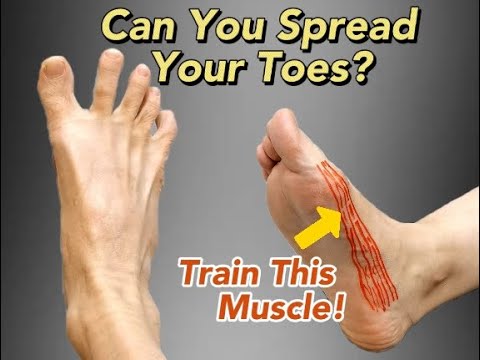 Hallux Valgus and Big Toe Pain- Can You Spread Your Toes Apart?