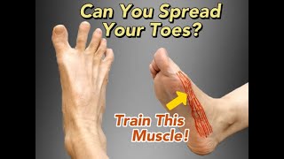 Hallux Valgus and Big Toe Pain- Can You Spread Your Toes Apart?