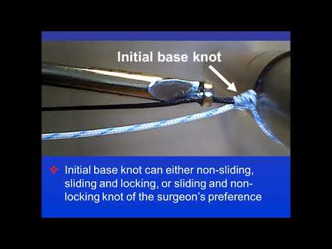 Reverse Flipping Technique: An Alternate Approach to Tie Reversing Half-Hitches on Alternating Posts