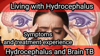 Hydrocephalus and Brain TB | Living with Hydrocephalus| Colours of life.