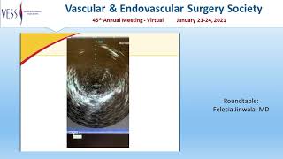 Download Lagu VESS Winter Annual Meeting (Virtual), Case Report u0026 Video Presentations Session, Talk 5 Thumbnail