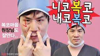 복코 성형 제일 NO답. 정말 답이 없는걸까?