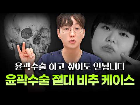땅콩형 얼굴 교정, 안면윤곽수술 전 반드시 확인해야 하는 것들ㅣ디에이성형외과ㅣ맞춤형안면윤곽수술상담