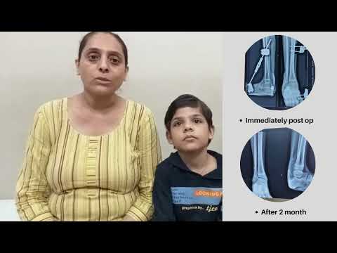 Total Knee Replacement — Patient