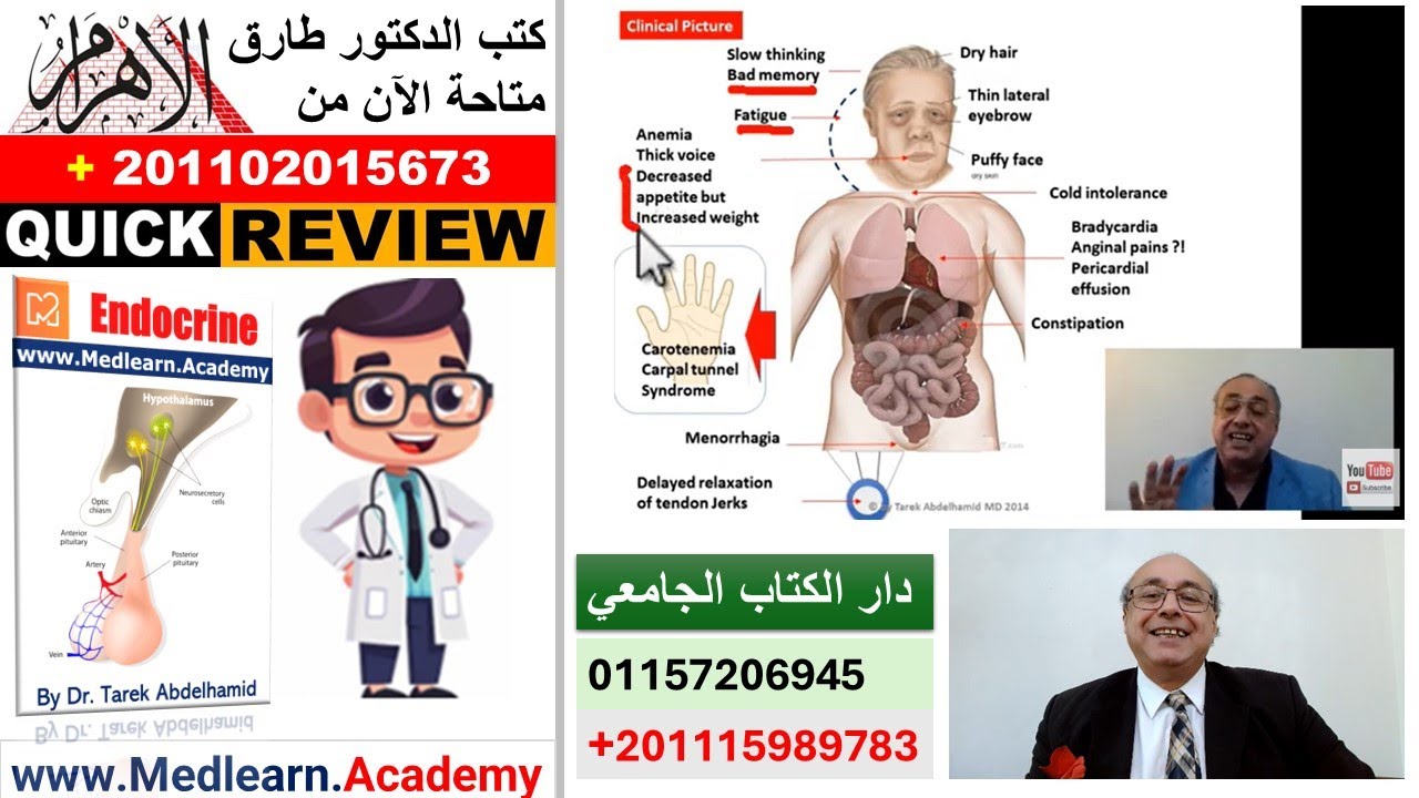 Hypothyroidism (Quick Review) #cme #internal_medicine #usmle #medicalstudent #محاضرات_باطنة