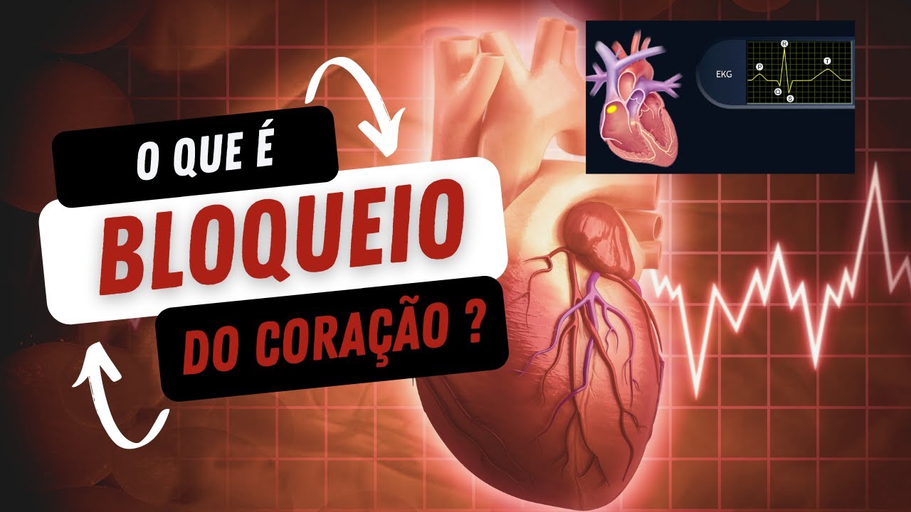 O que é bloqueio do coração É perigoso ter bloqueio no coração