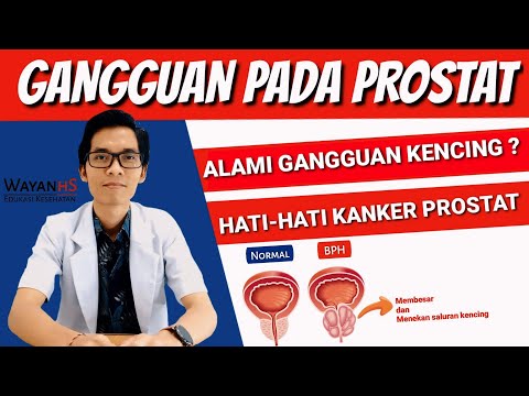 Hogyan befolyásolja a prosztatitis a tesztoszteront