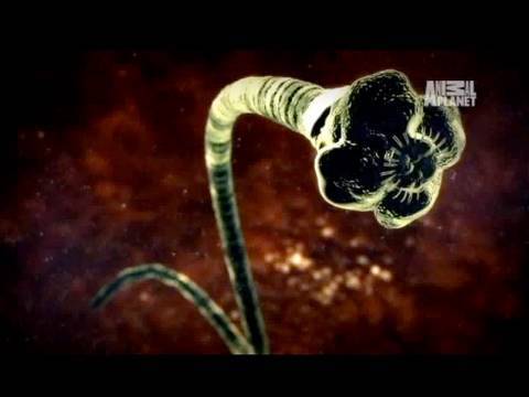 Lowdown paggamot ng kuko halamang-singaw Toenail fungus senile
