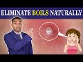 Say Goodbye To Painful Boils Forever Ayurvedic Treatment And Remedies