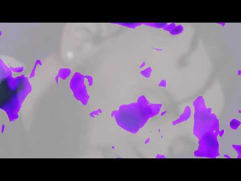 Austen Tree$ - Trees/Cannabis Feat Kenzo Kash