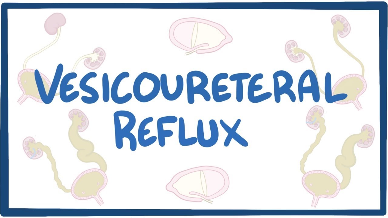 Vesicoureteral reflux - causes, symptoms, diagnosis, treatment, pathology
