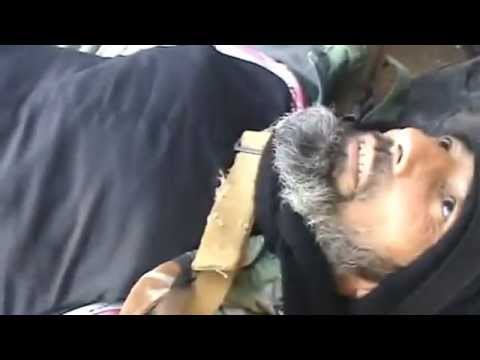 إصابة أحد عناصر كتائب الفاروق أثناء الإشتباكات مع حزب العمال bkk في مدينة رأس العين في الحسكة