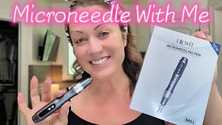 Step by Step Microneedling Tutorial for Beginners