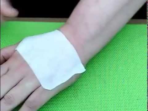 Hyperglykämischen Koma, diabetischer ketoatsidoticheskaya Pankreatitis und Diabetes Typ 2 Mahlzeiten