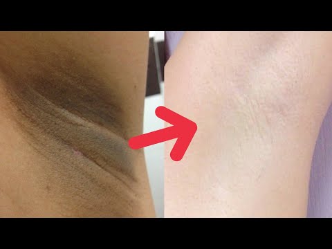 Diet dengan ulasan sup sayuran diet Foto mativiruyuschee untuk kehilangan berat