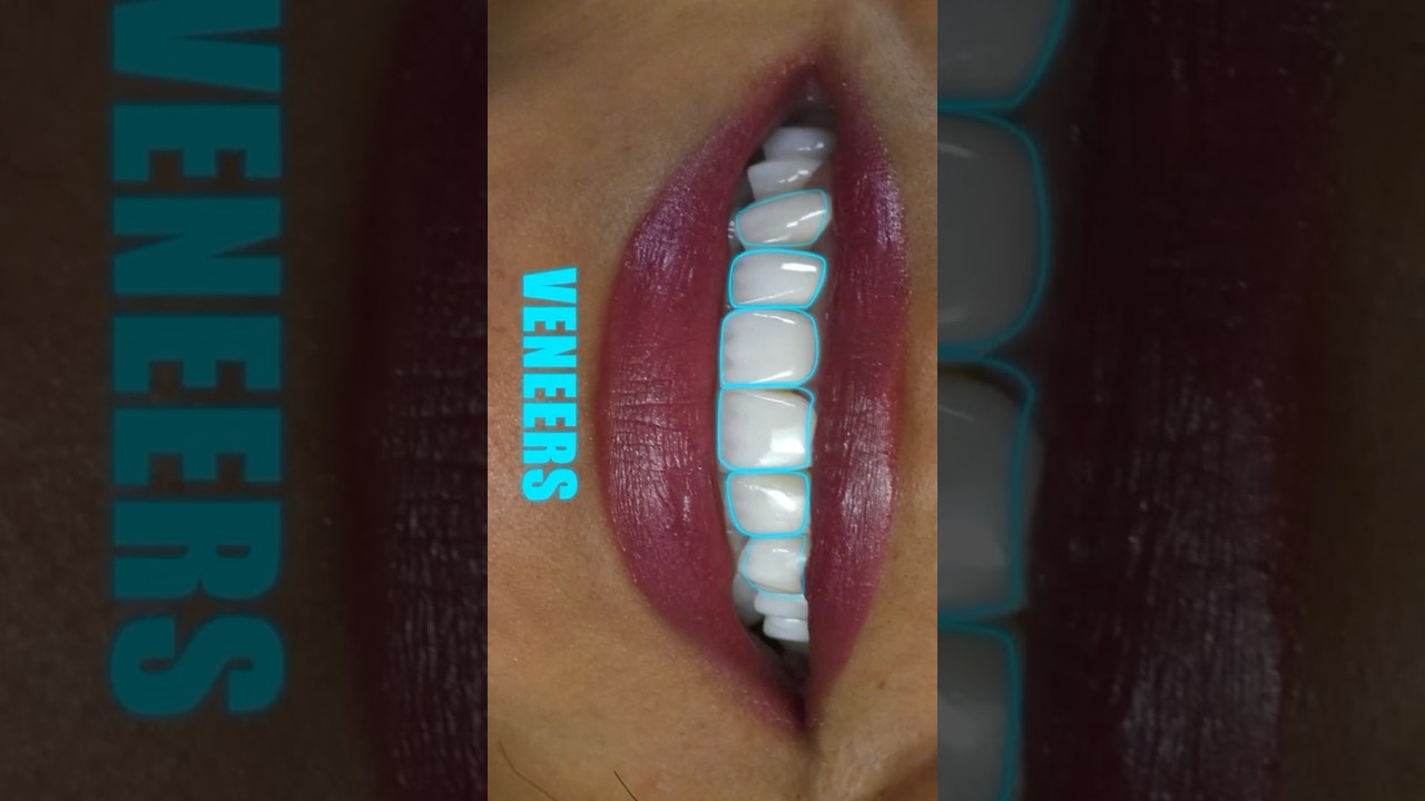 Dental Motion Graphic | Animation that Makes You Smile #dentistry #dentist #dental_motion_graphic