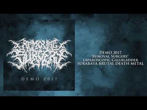 Removal Surgery - Teaser Demo 2017