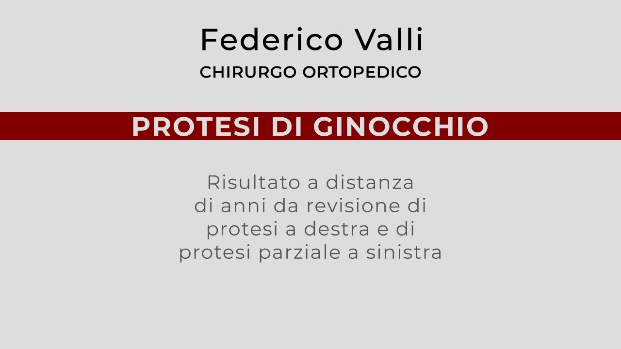 Federico Valli-9