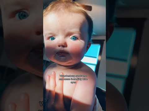 My favorite ocean eyes in the whole world.