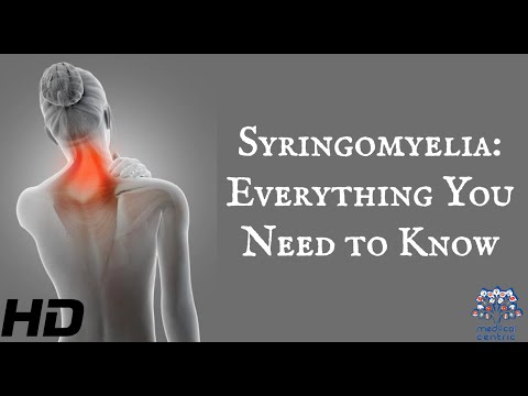 Effects of Cannabis on your body