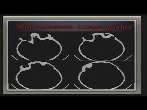 CEUTEH 2017: Mobile CT; A Cost effective Solution