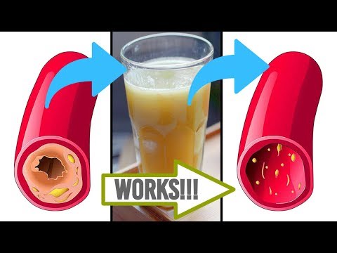 Glass of This Juice will Remove Clogged Arteries And Control Blood Pressure