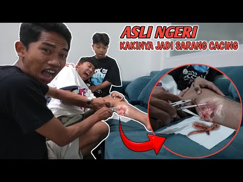 KAKI SAPUTRA TIBA TIBA BENGK4K DAN KELUAR C4C1NG BEGINI??ARIK PANIK😱 | Mikael TubeHD