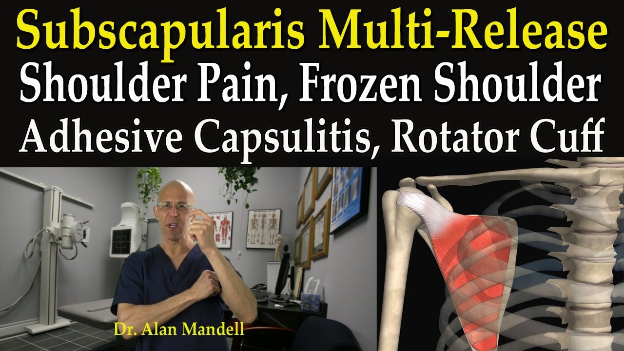 Subscapularis Multi-Release Technique for Frozen Shoulder, Bursitis, Rotator Cuff - Dr Mandell - YouTube