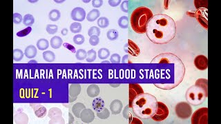 Malaria Parasites  Blood stages Identification Training  - Quiz 1