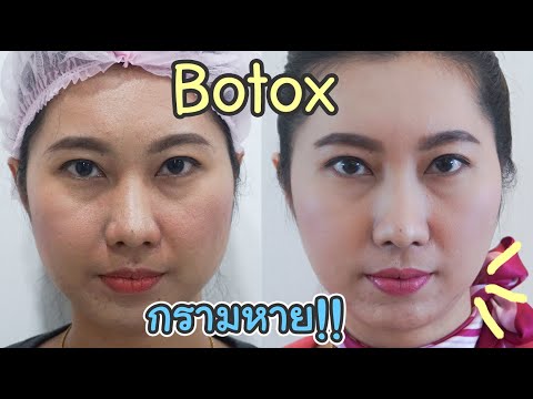 โบท็อก ลดริ้วรอย