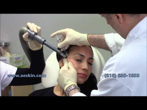 A E皮膚肉毒素注射示範 (A E Skin Botox Injection Demonstration)