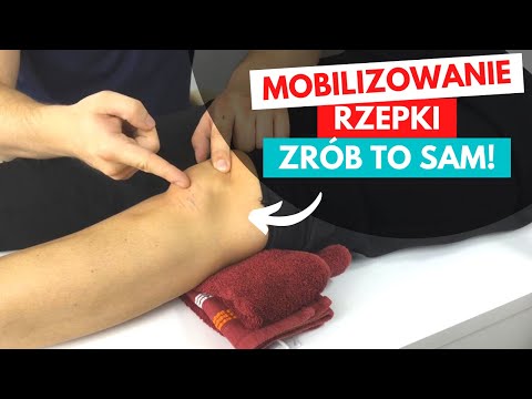 JAK DBAĆ O RZEPKĘ PO OPERACJI? - MOBILIZOWANIE RZEPKI - TOP 3 PORADY !