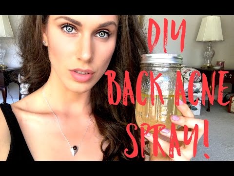 🌿 DIY Back Acne Spray (5 Ingredients)! | Cassandra Bankson Video