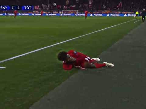 FC Bayern Spieler hat sich verletzt💔