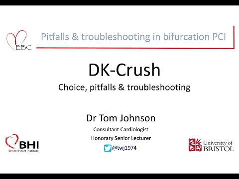 DK-Crush: Choices, pitfalls & troubleshooting - Dr Tom Johnson