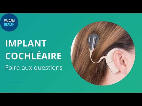 IMPLANT COCHLÉAIRE