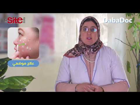 الدكتورة الدباغ تكشف أسباب وعلاج حب الشباب