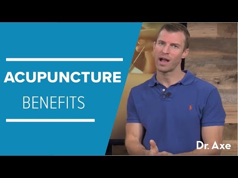 Acupuncture Benefits to Improve Your Health