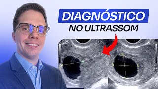 Gestação Anembrionada: como diagnosticar o ultrassom sem erro