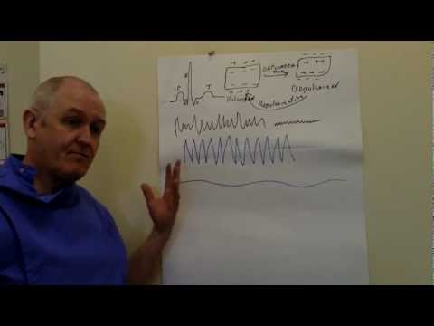 ECG (EKG), Sinus rhythm and abnormalities