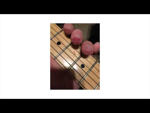 Video thumbnail for Tinnitus