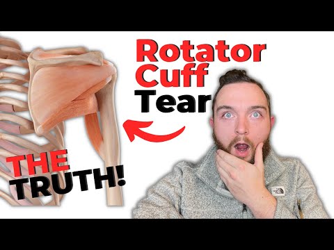 The TRUTH About Your Rotator Cuff Tear! (FIX SHOULDER PAIN!!)